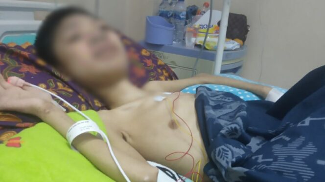 
 Alami Lumpuh dan Penyempitan Saraf. Remaja Di Abdya membutuhkan uluran tangan para Darmawan untuk berobat. Foto/Foto : T. Sultan (Jimmy) for gumpalannews.com